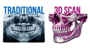 전통적 진단과 3D CT 진단의 비교 다이어그램